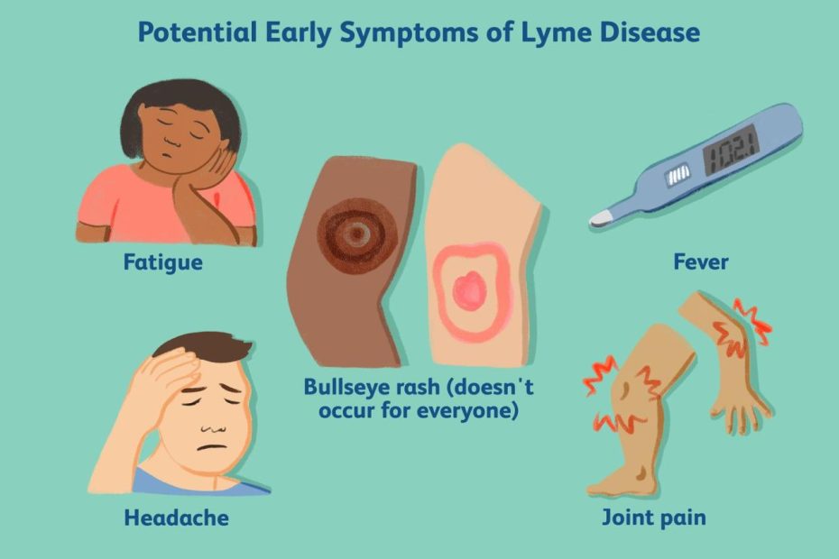 Untreated Lyme Disease: Signs, Symptoms, And Complications